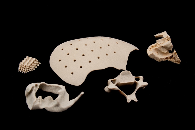 Oxford Performance Materials’ 3D-printed parts find use in medical implants, aerospace fields